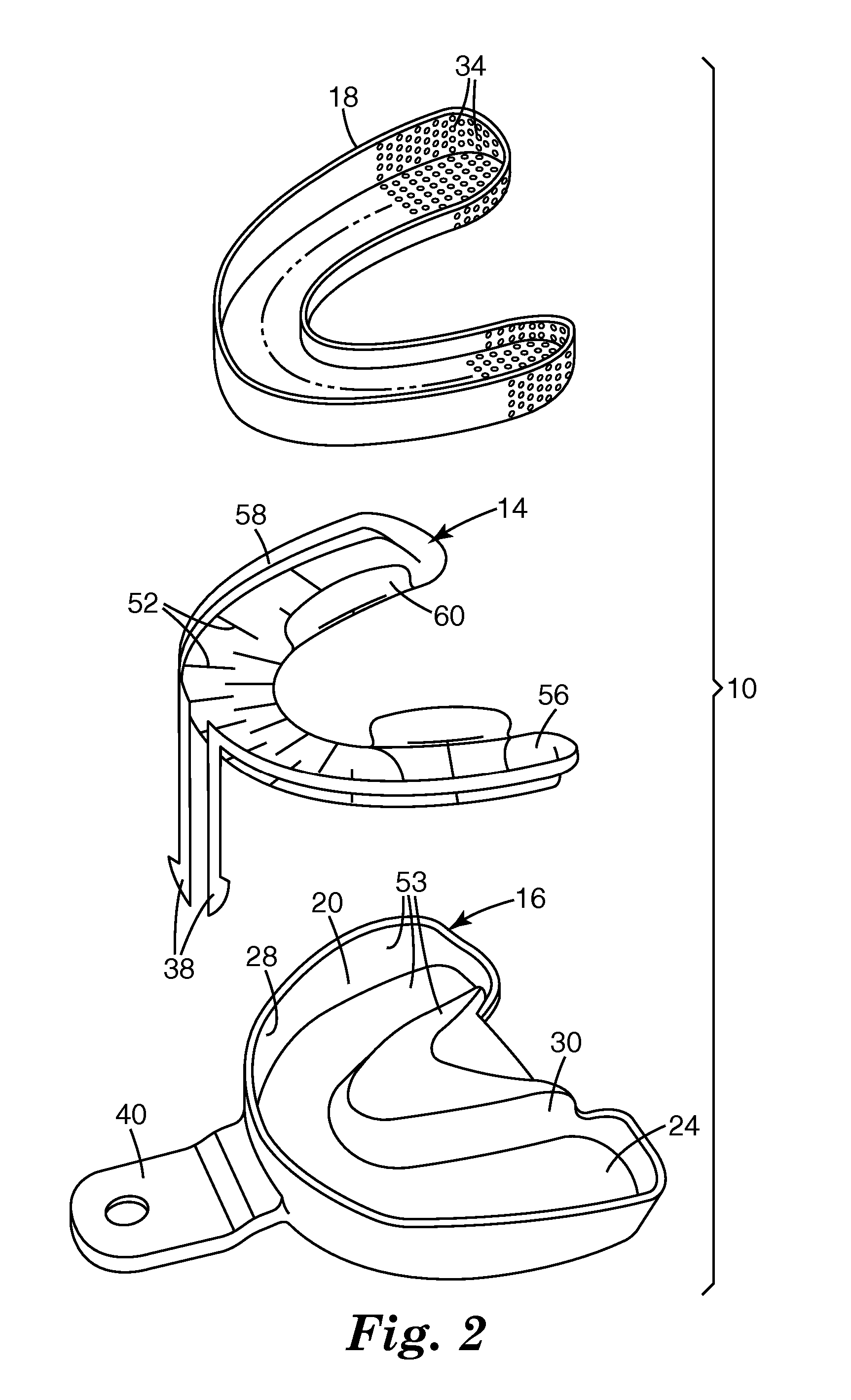 Thermally accelerated dental imressions