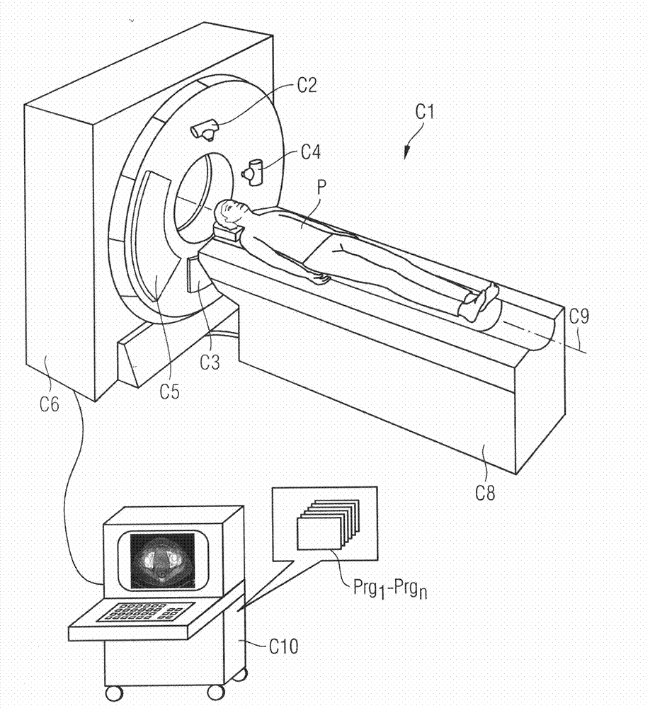 Method, computing unit, CT system and C-arm system for reducing metal artifacts