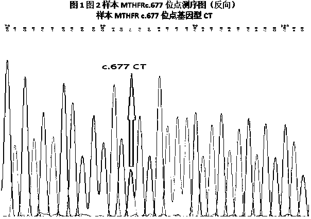 Full premix MTHFR and MTRR multiple PCR gene polymorphism detection kit and method thereof