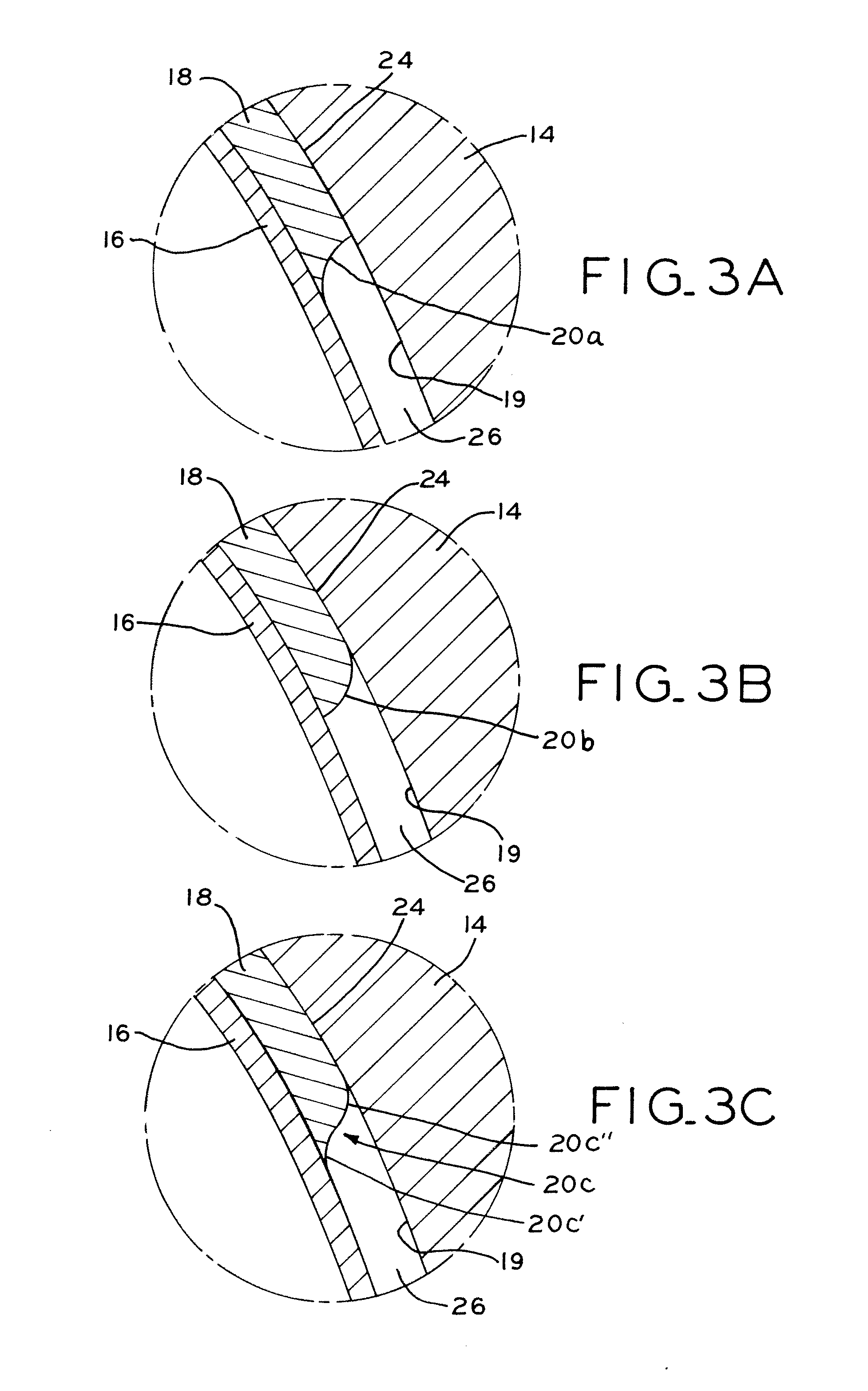 Bi-material prosthesis component