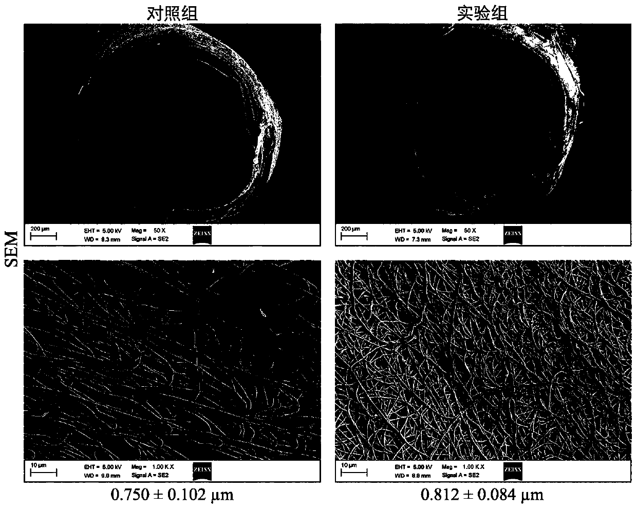 Artificial intravascular stent and preparation method and application thereof