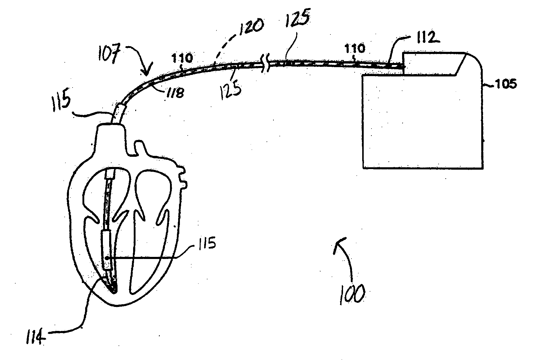 Systems and methods for characterizing leads