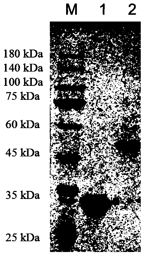 Application of zearalenone lactone hydrolase RmZHD in degradation of macrolide antibiotics