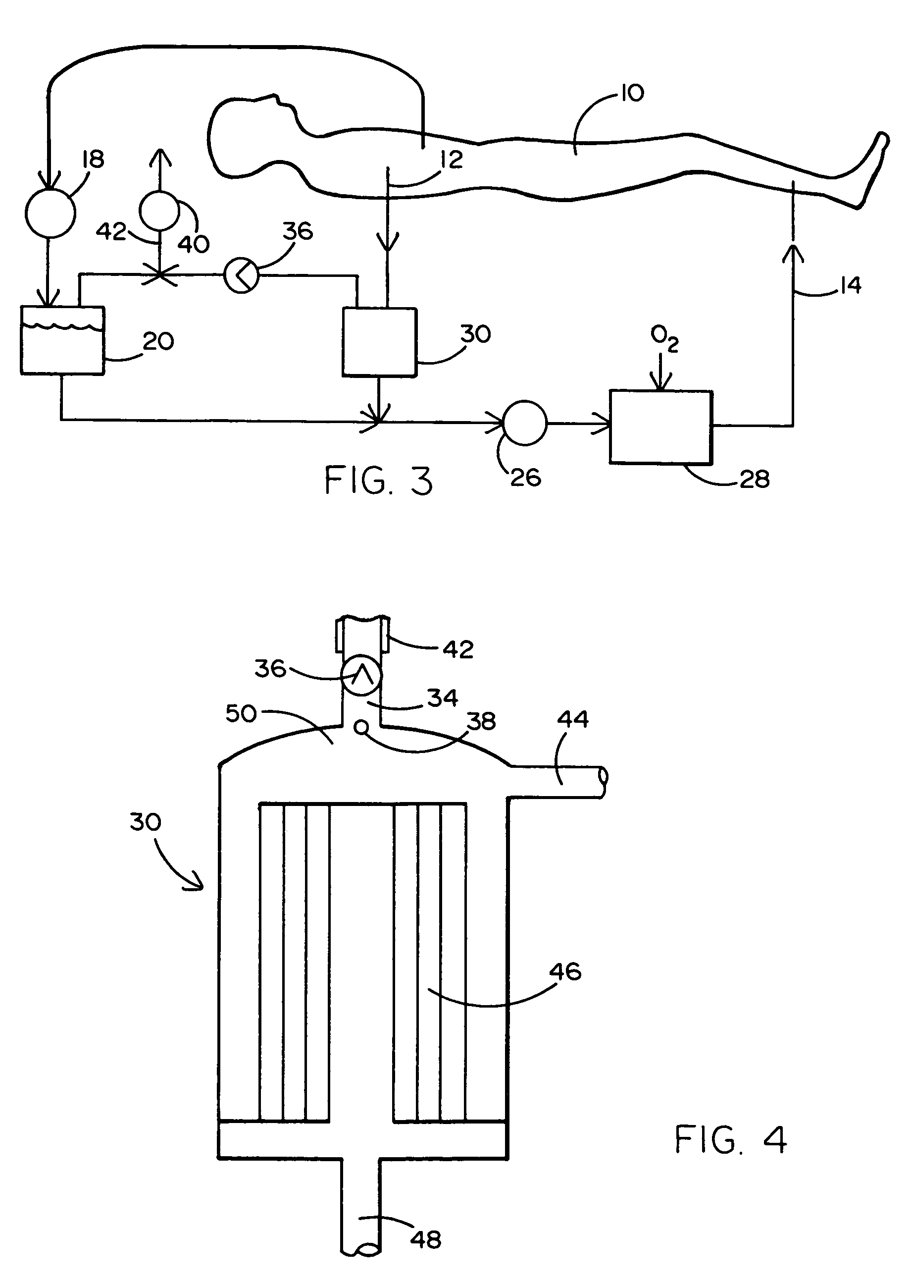 Venous filter for assisted venous return