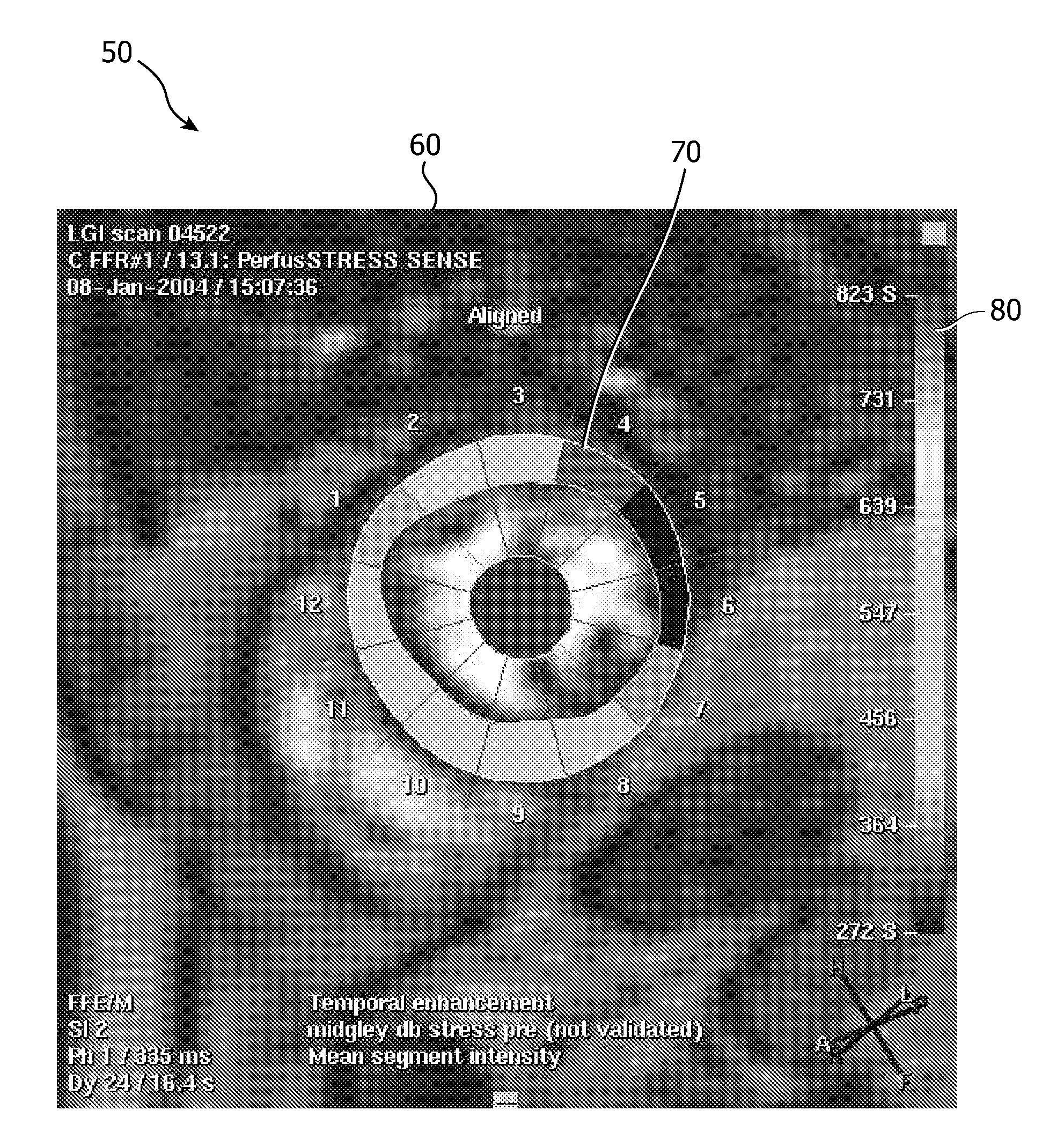 Visualizing a time-variant parameter in a biological structure