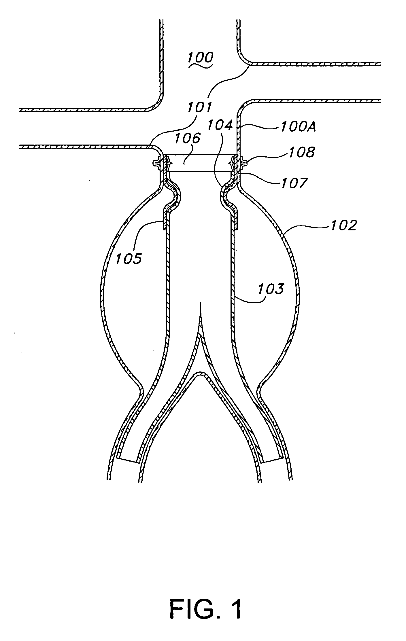 Prosthesis fixation device and method