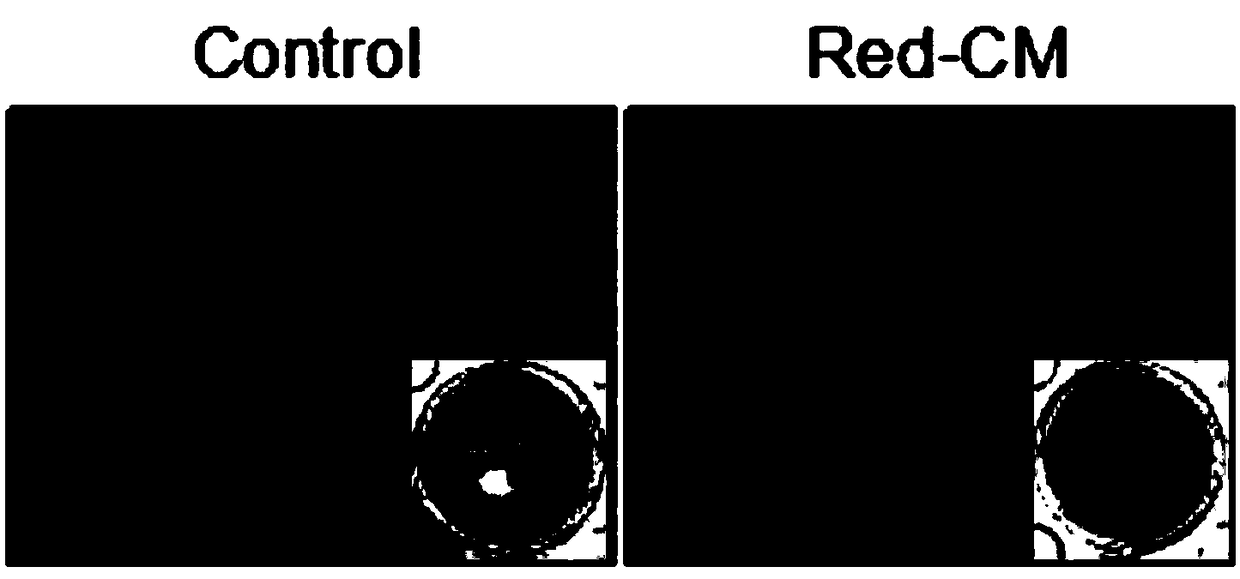 Application of LED-red light with wavelength of 610-650 nm in relieving symptoms of lumbar muscle strain