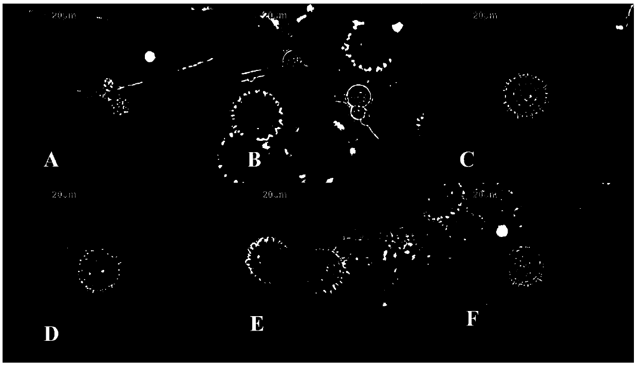 Application of Pythium oligandrum fermentation mycoplasma in antitumor