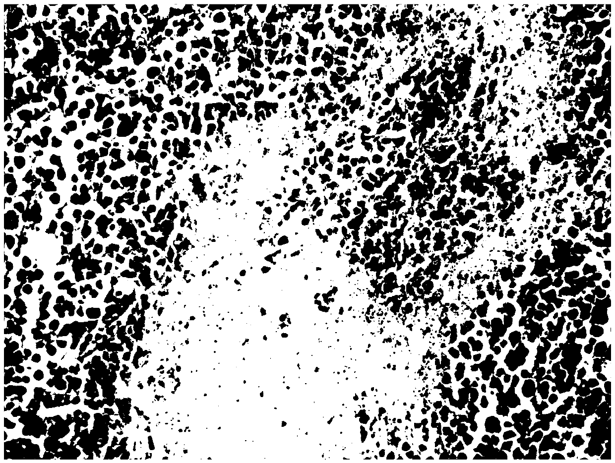 Application of Pythium oligandrum fermentation mycoplasma in antitumor