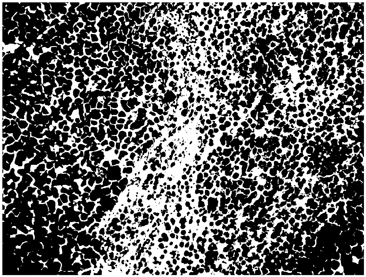 Application of Pythium oligandrum fermentation mycoplasma in antitumor