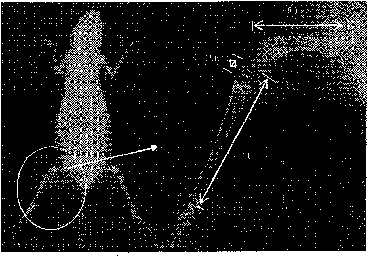 Growth-enhancing yeast hydrolysate and health food comprising the same