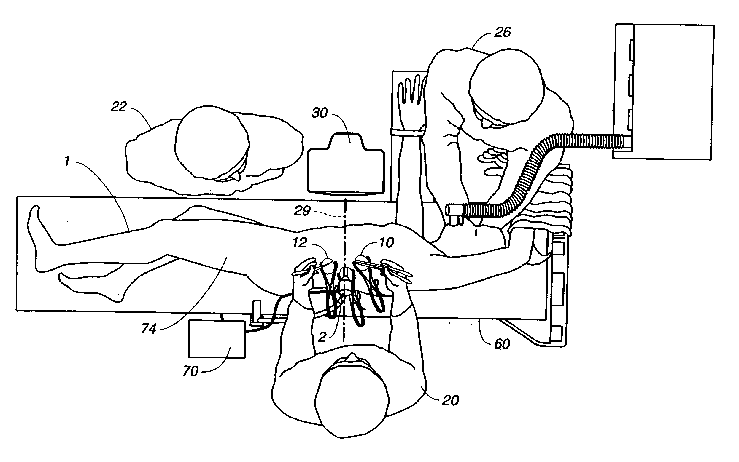 Visualization during closed-chest surgery