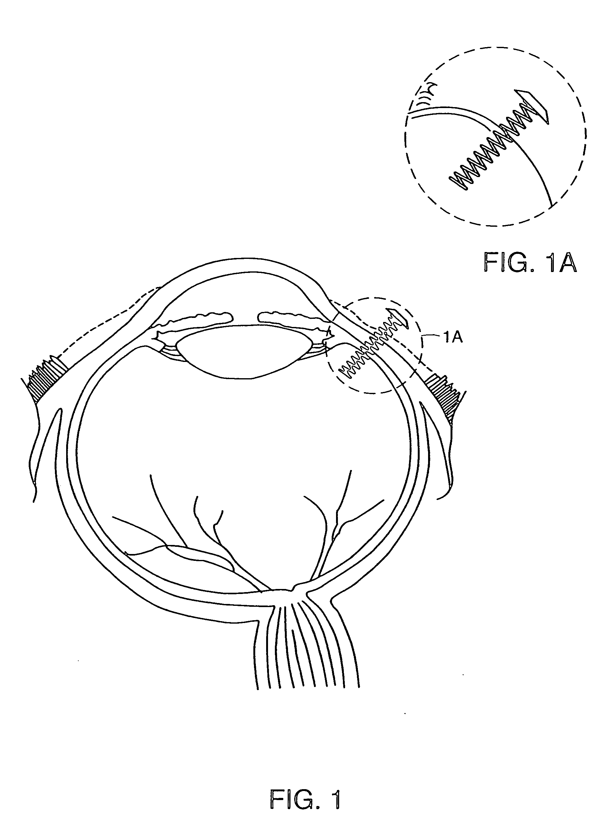 Devices for intraocular drug delivery