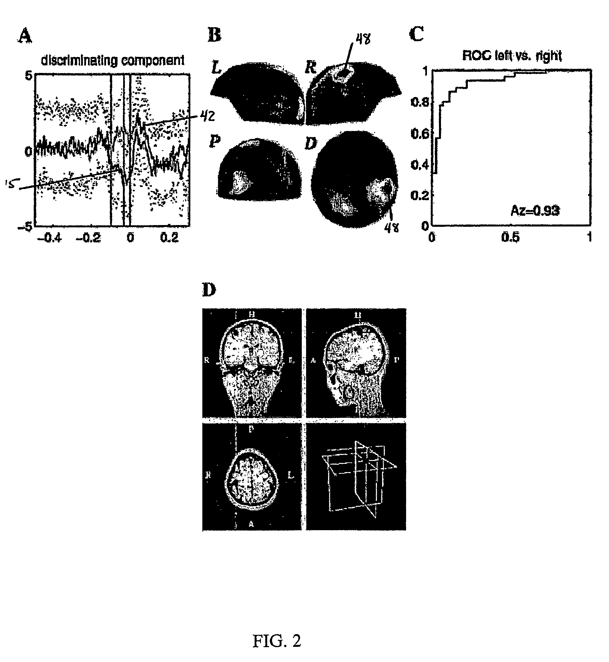 Single trial detection in encephalography