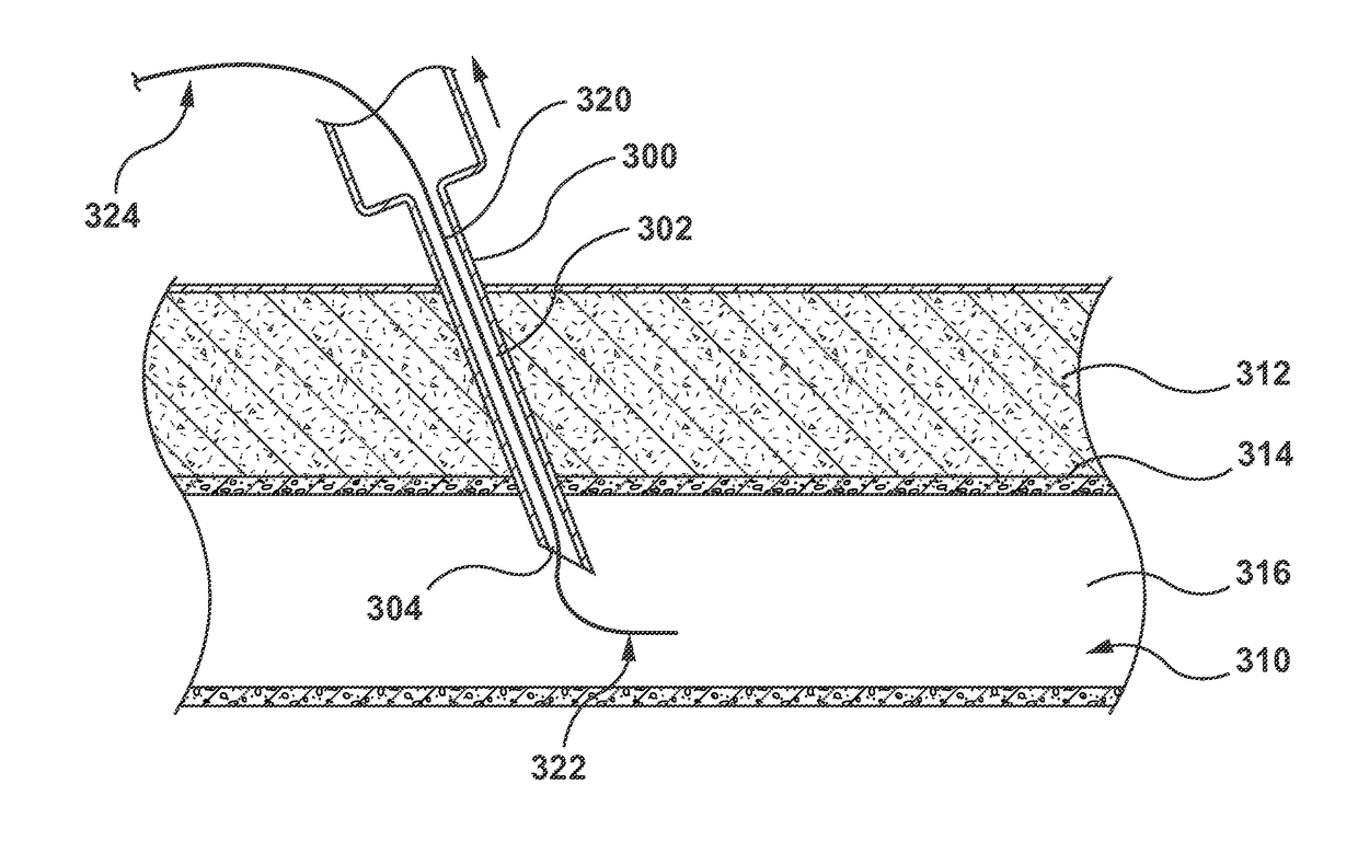 Sheathless Guide Catheter Assembly