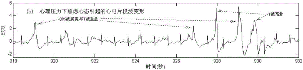 Lie detection method based on electrocardio measure