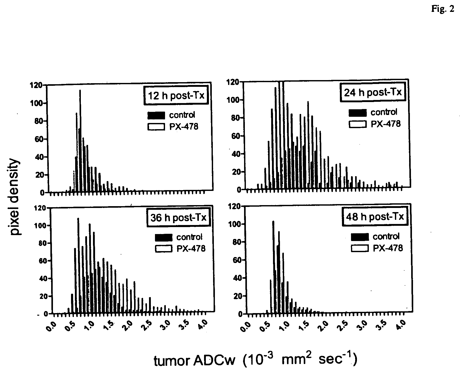 Method of preselection patients for anti-VEGF, anti-HIF-1 or anti-thioredoxin therapy