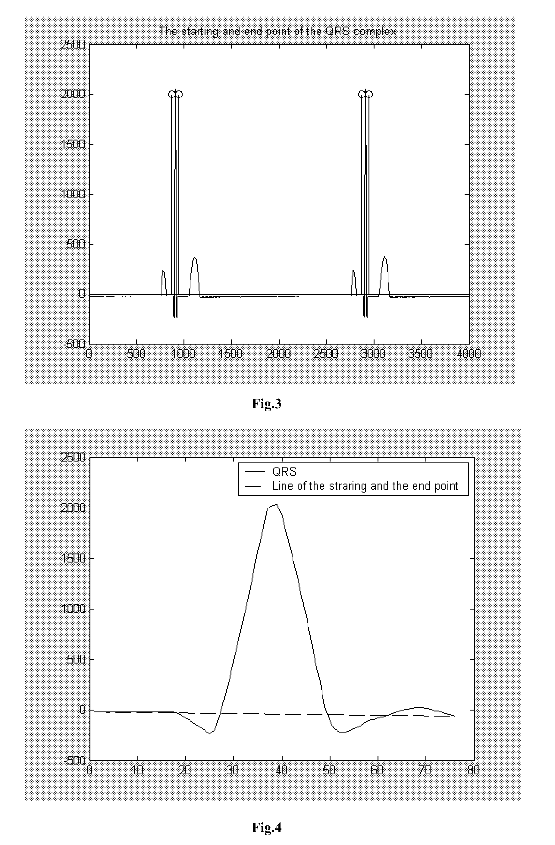 Method for the Elimination of Ringing of Power Line Interference Filter