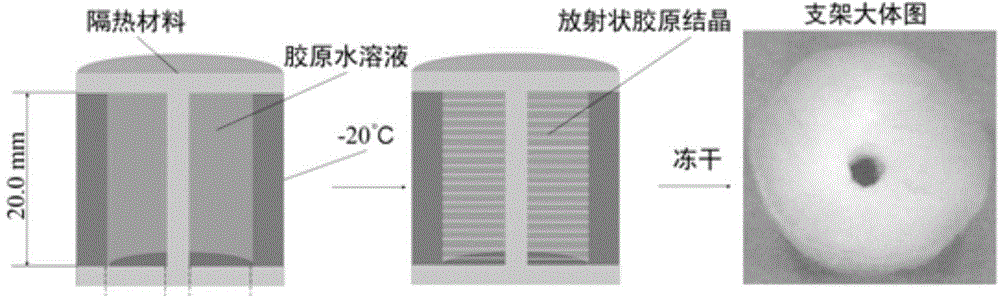 Preparation method of radial collagen scaffold in combination with stromal cell derived factor and application of radial collagen scaffold in combination with stromal cell derived factor to osteochondral defect repair