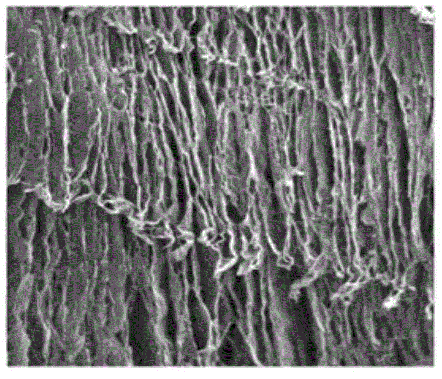 Preparation method of radial collagen scaffold in combination with stromal cell derived factor and application of radial collagen scaffold in combination with stromal cell derived factor to osteochondral defect repair