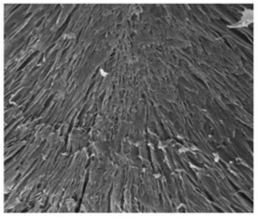 Preparation method of radial collagen scaffold in combination with stromal cell derived factor and application of radial collagen scaffold in combination with stromal cell derived factor to osteochondral defect repair