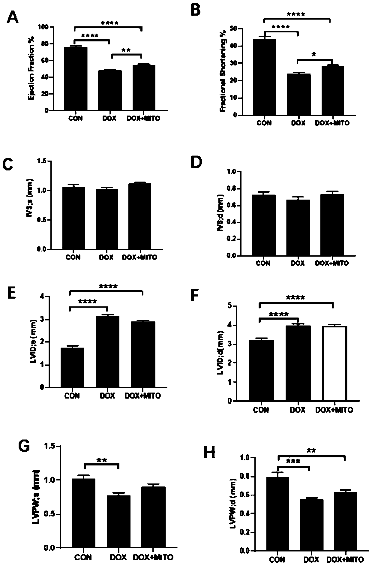 Application of mitochondrial transplantation in treatment of primary dilated heart disease