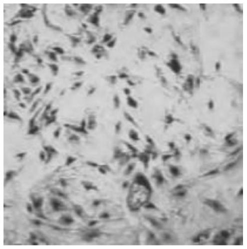 Human prostate epithelial cell separating and culturing method