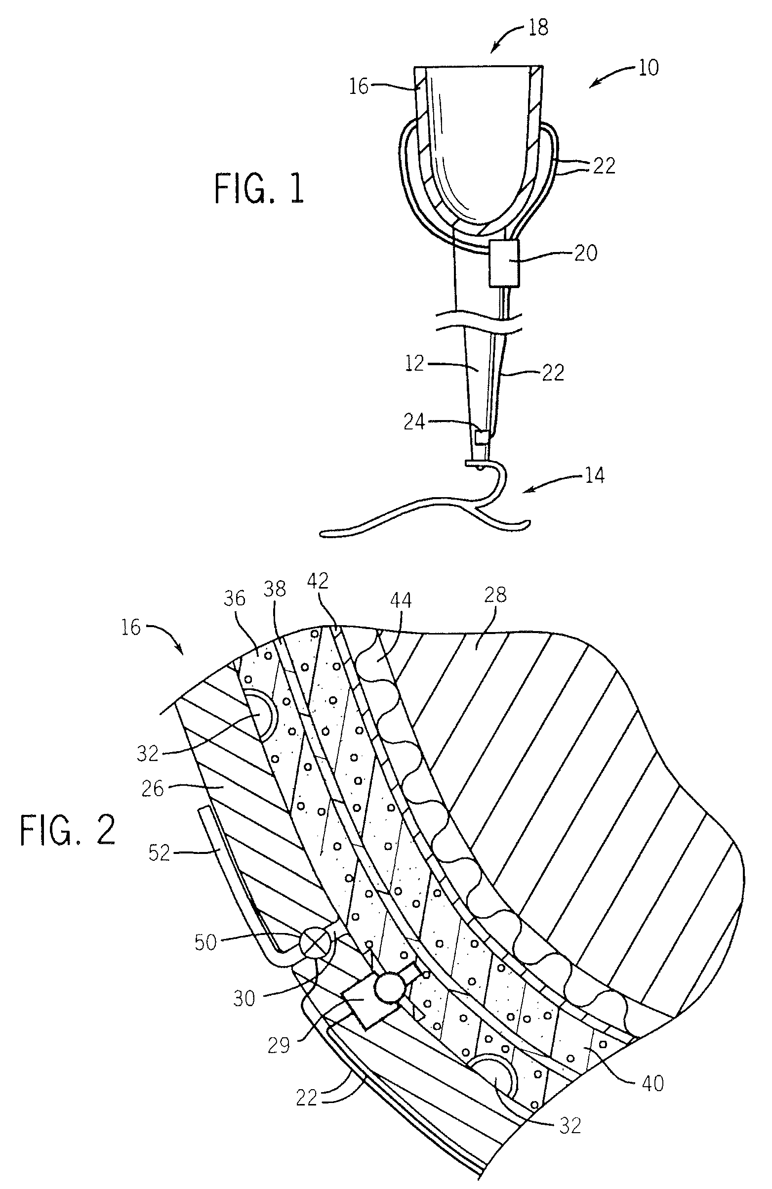 Prosthetic socket with real-time dynamic control of pressure points