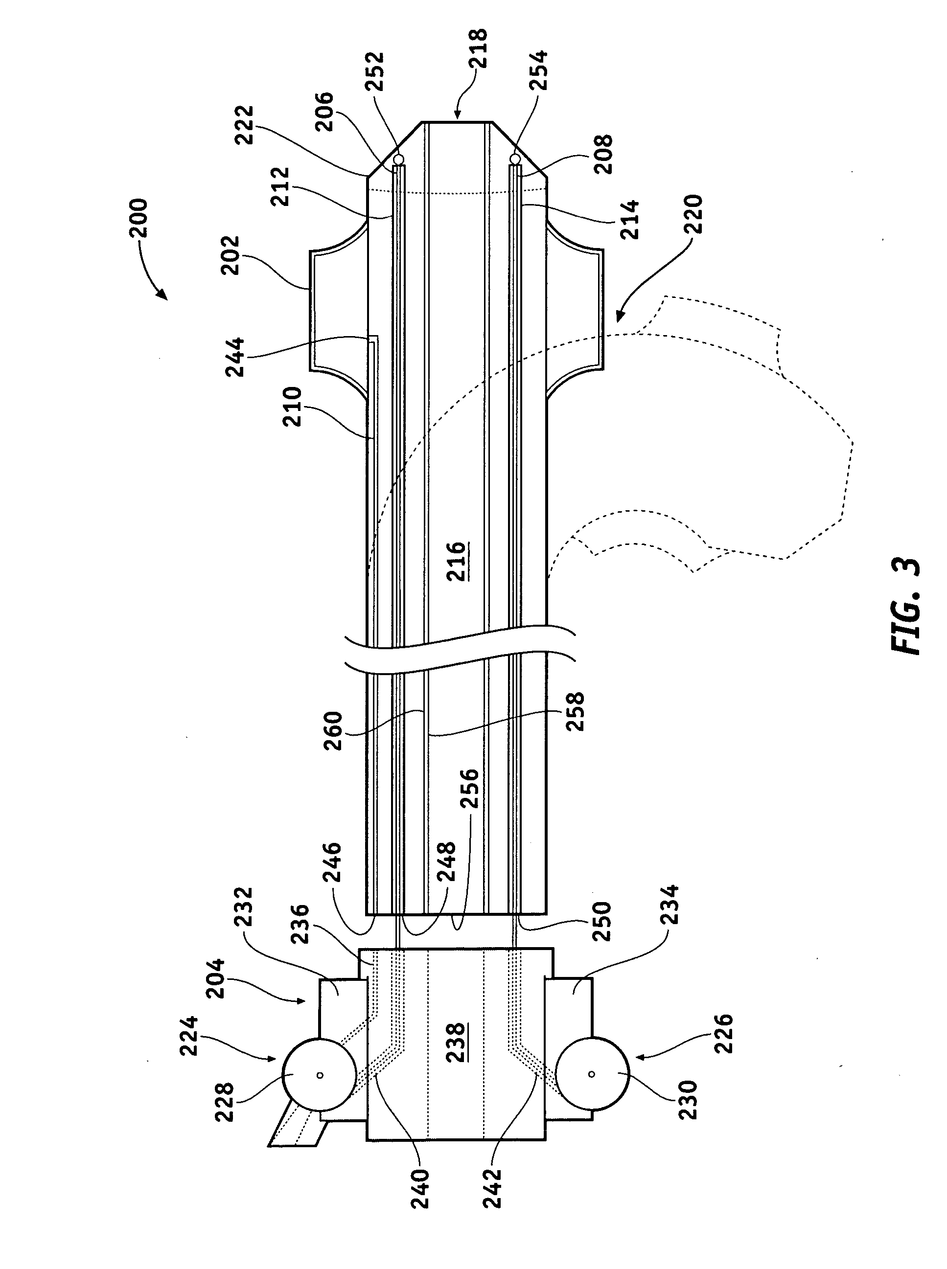 Guiding catheter assembly for embolic protection by proximal occlusion