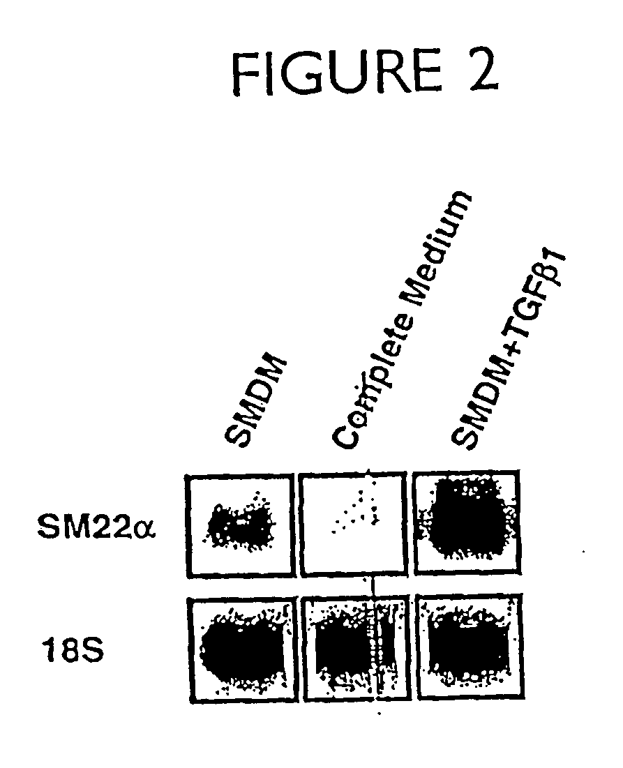 In vitro differentiation of vascular smooth muscle cells, methods and reagents related thereto