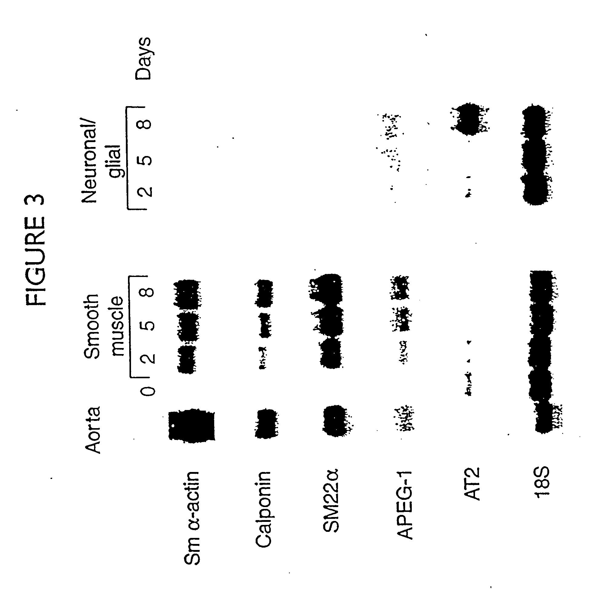 In vitro differentiation of vascular smooth muscle cells, methods and reagents related thereto