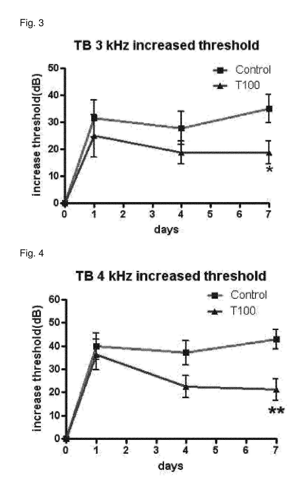 Composition for preventing or treating hearing loss