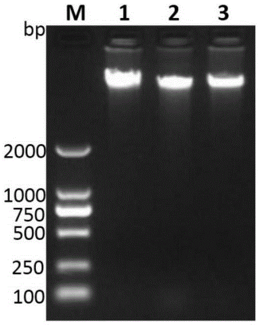 Liver abscess inducing Klebsiella pneumonia specific gene sequence lak and application thereof