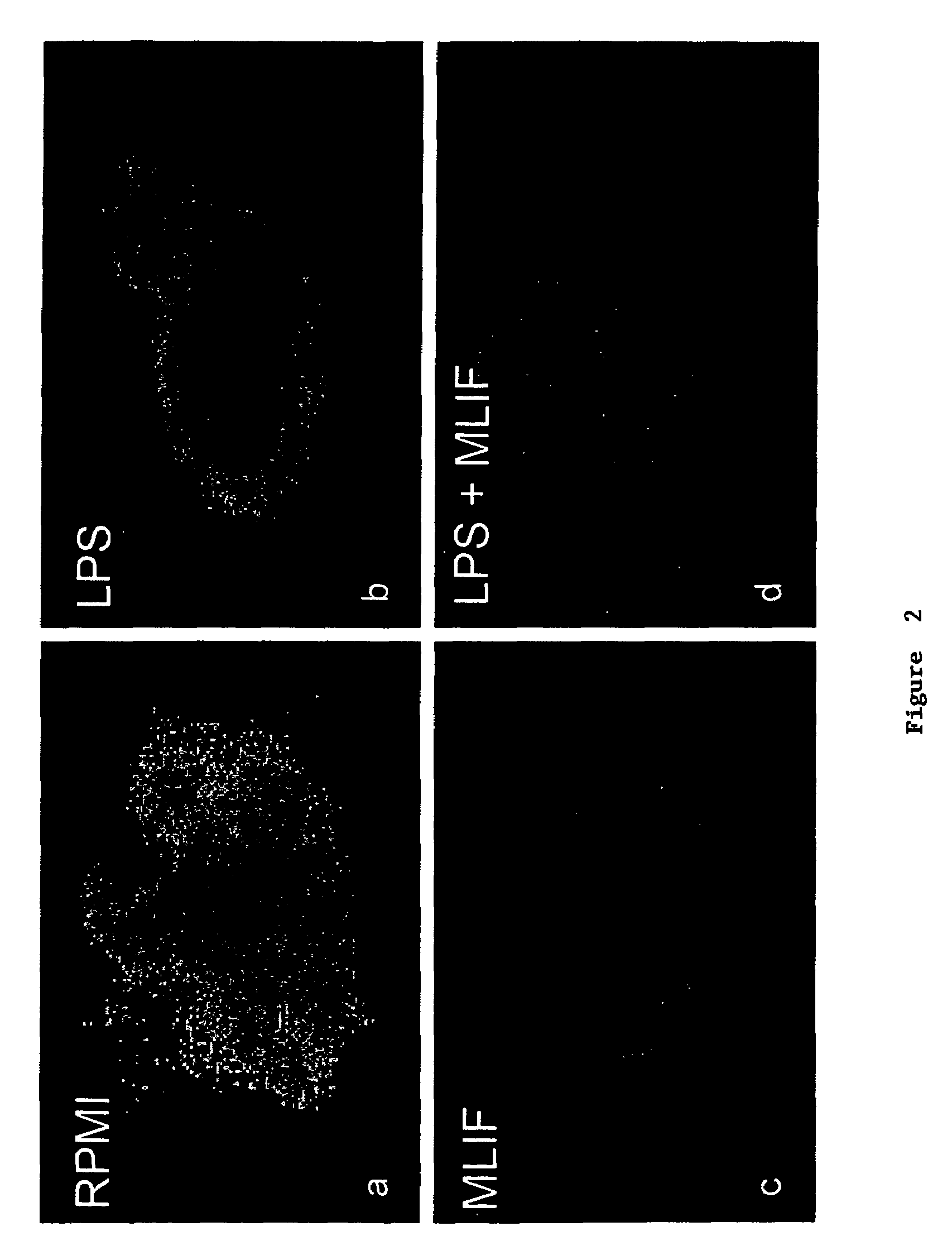 Monocyte locomotion inhibitory factor