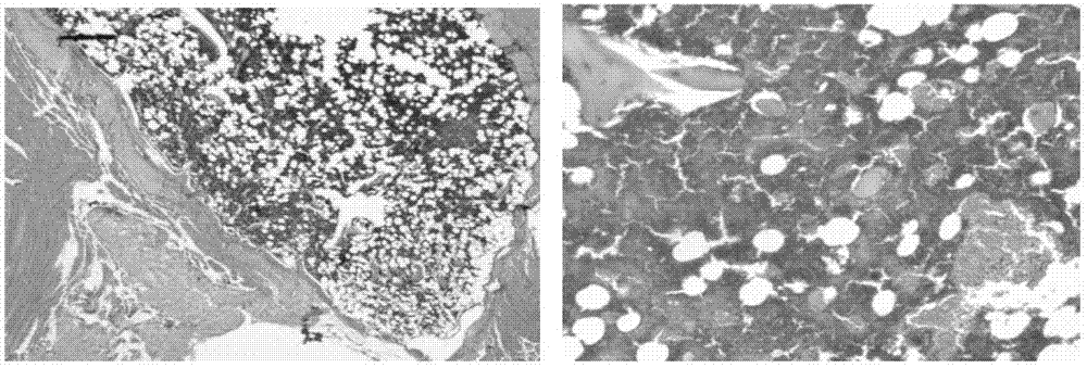 Biological activity factor composition for promoting ossification and vascularization