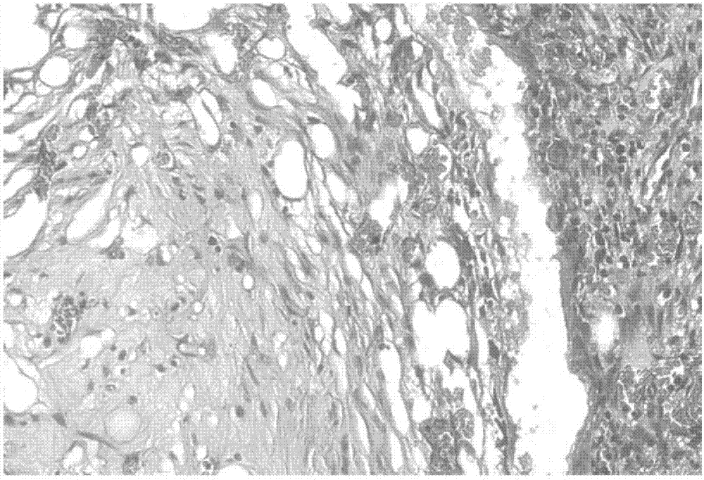 Biological activity factor composition for promoting ossification and vascularization