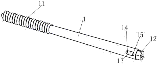 An integrated fixation device for olecranon fracture