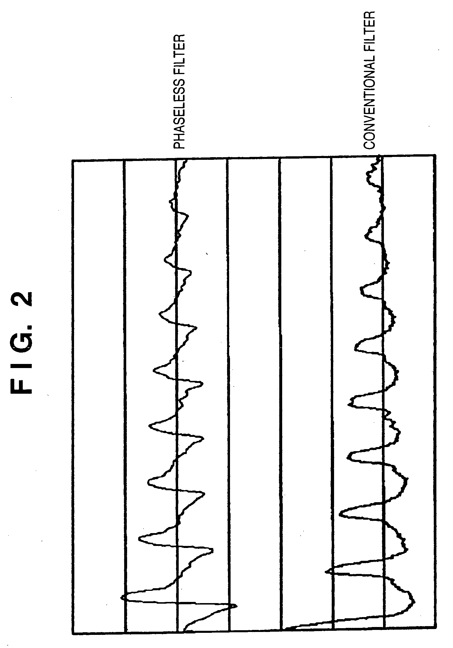 Blood pressure measuring apparatus