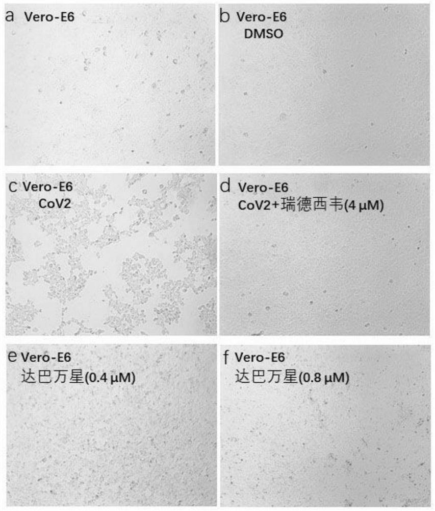 Application of dalbavancin in the preparation of drugs for inhibiting the combination of sars-cov-2 and ace2