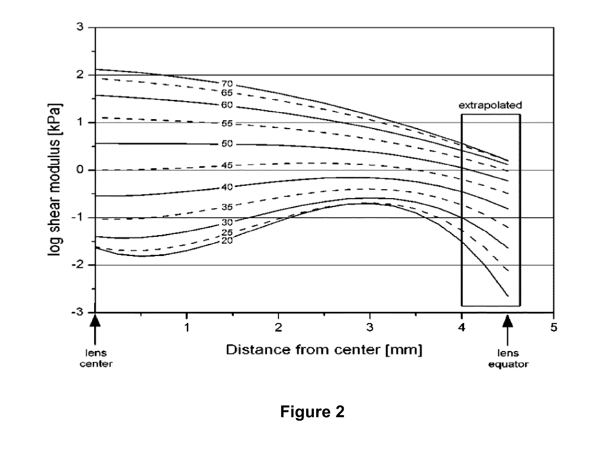 Methods of treating ocular diseases using derivatives of lipoic acid