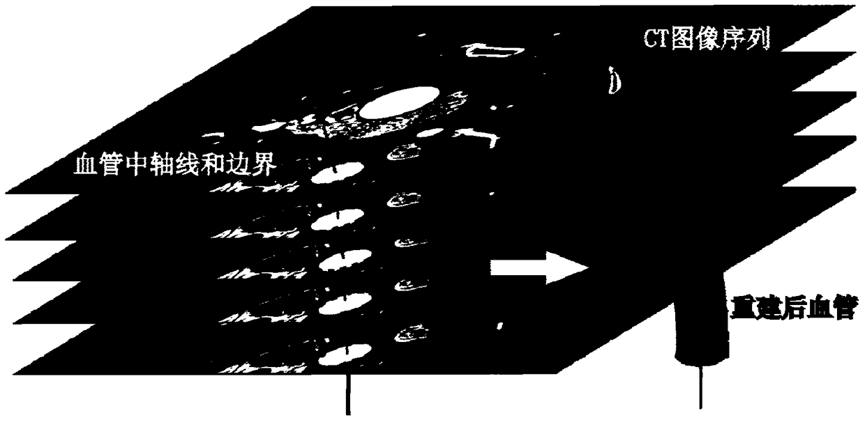 Coronary blood flow simulation system and method based on computational fluid dynamics