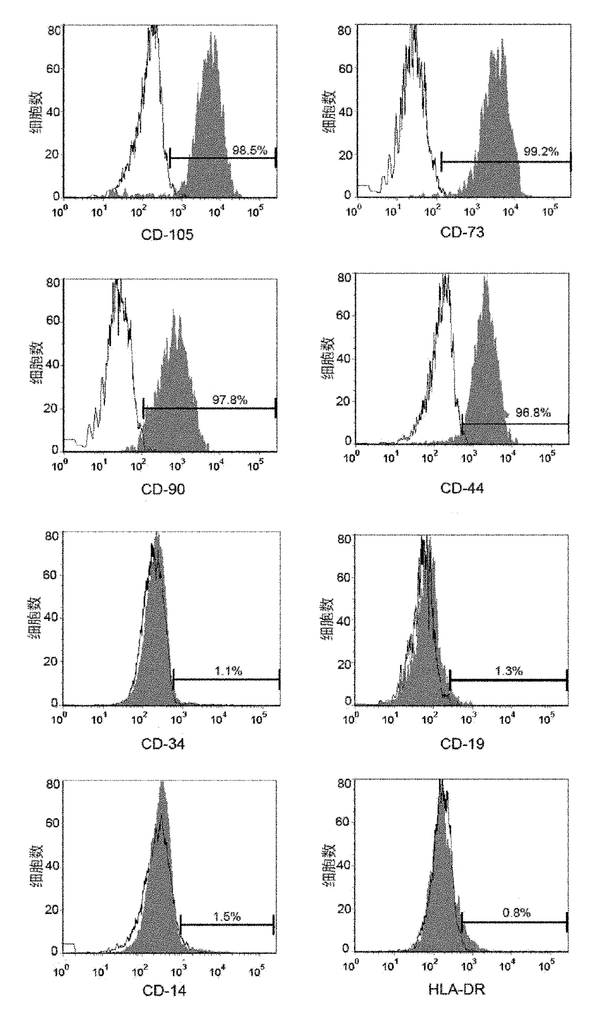 Method for inducing human umbilical cord mesenchymal stem cells in vitro into liver cells and application thereof