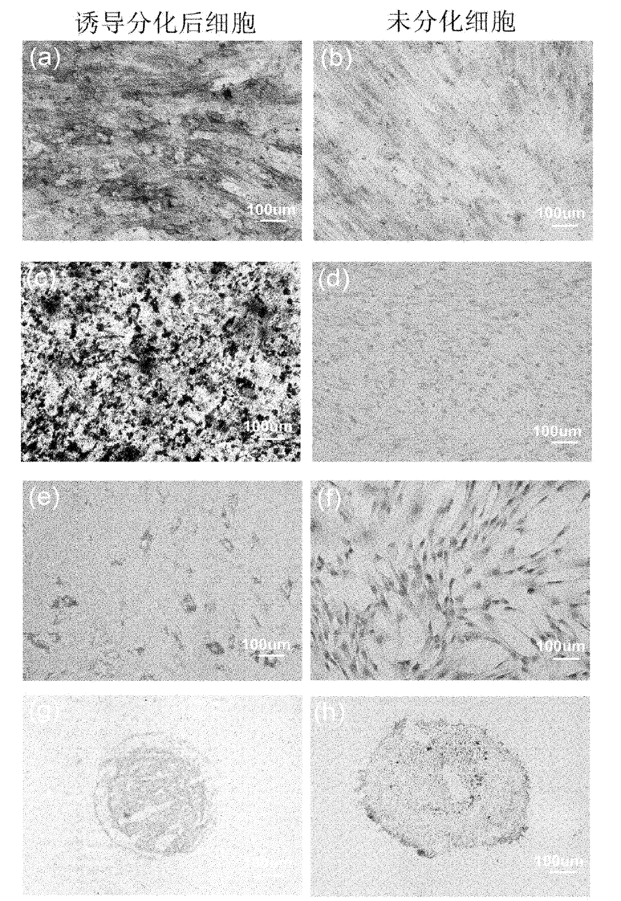 Method for inducing human umbilical cord mesenchymal stem cells in vitro into liver cells and application thereof