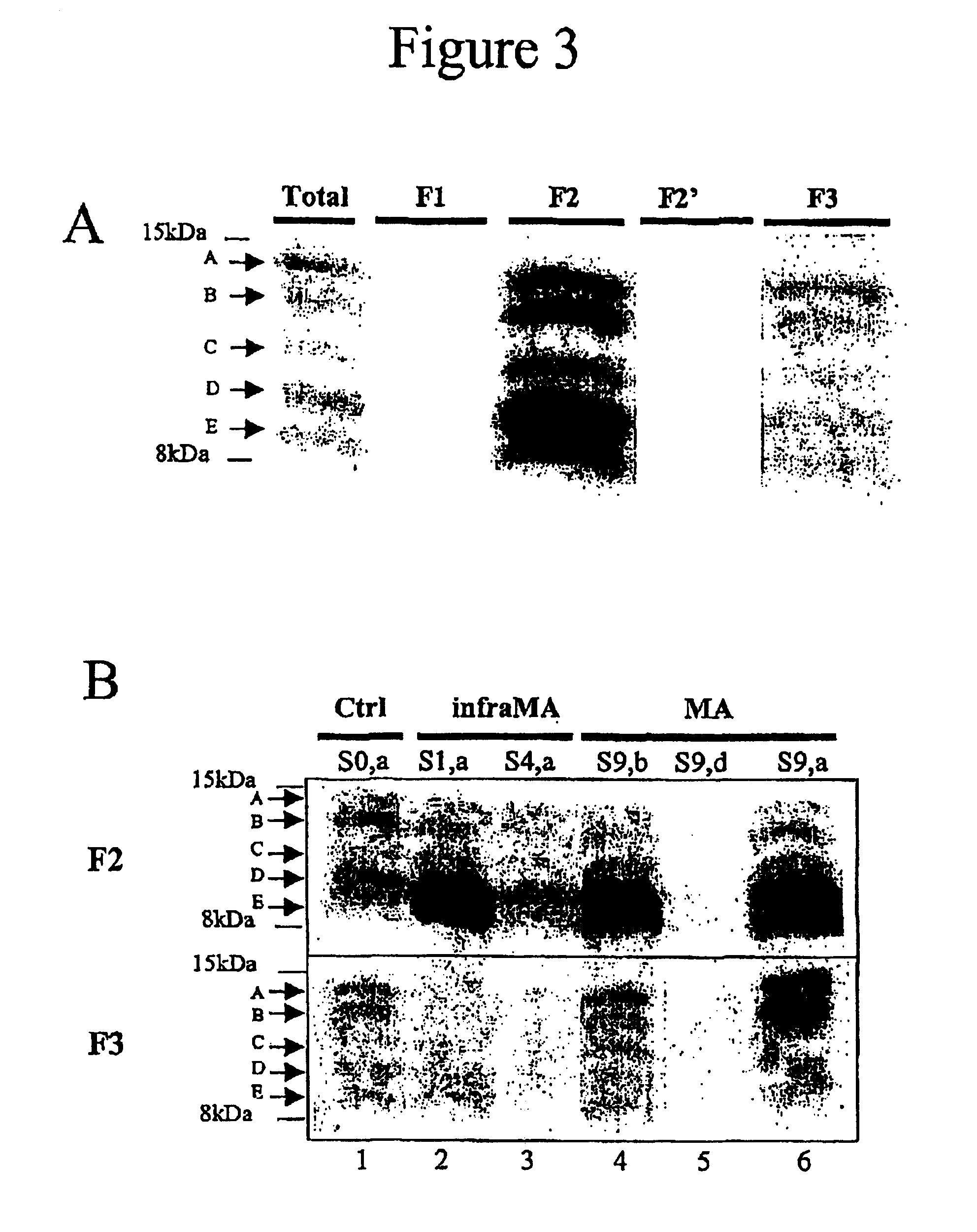 Means for detecting pathological transformation of the app protein and their uses