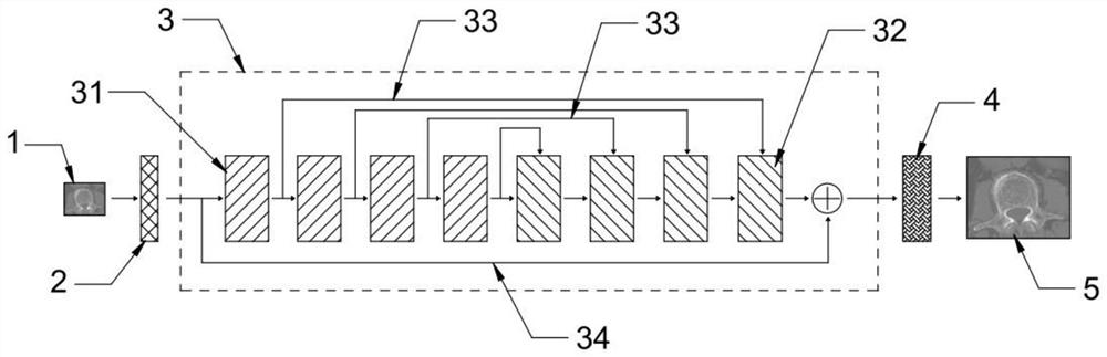 Method and device for detecting osteoporosis by using CT (Computed Tomography) image