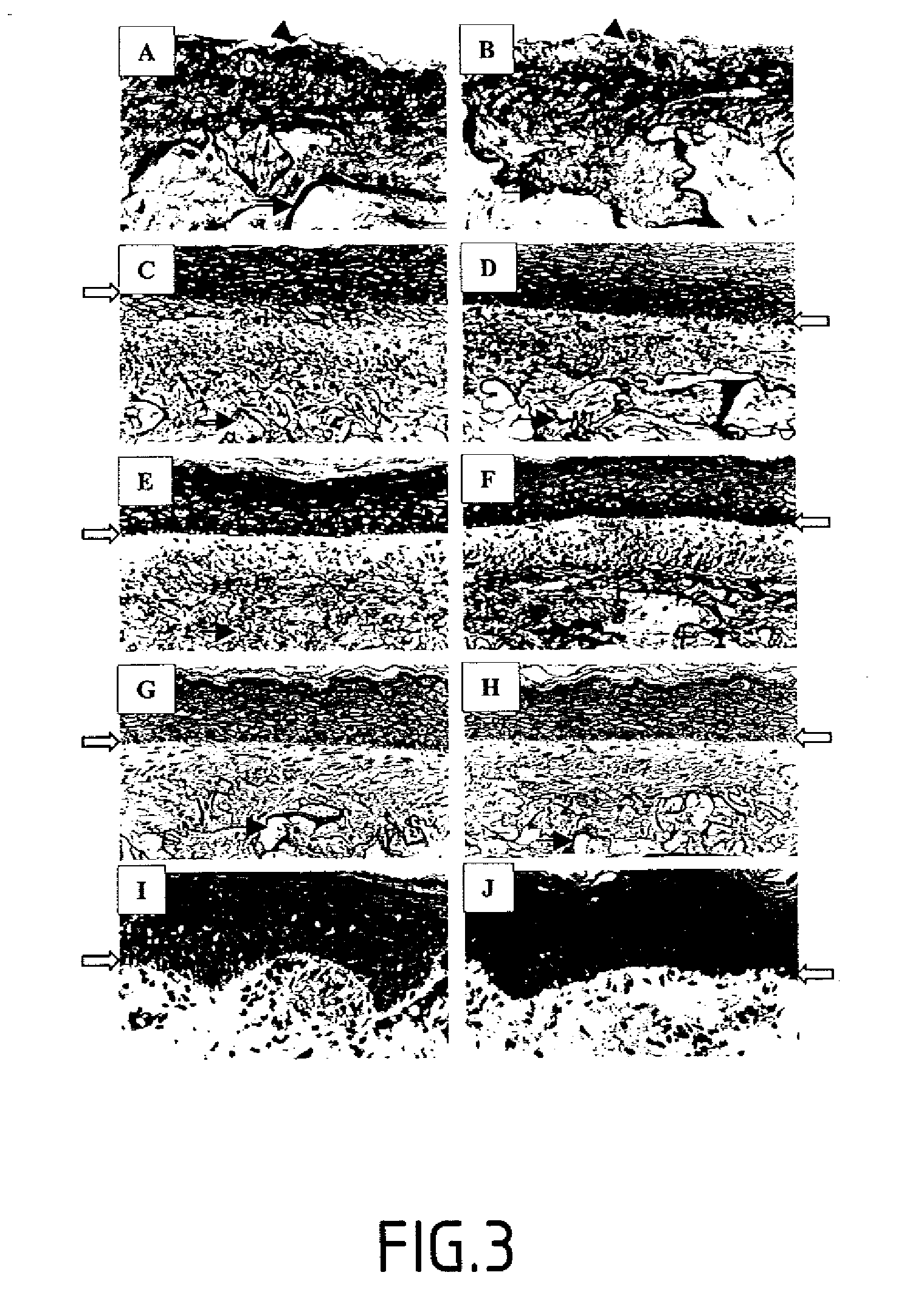 Stimulation of the synthesis and of the activity of an isoform of lysyl oxidase-like LOXL for stimulating the formation of elastic fibers.