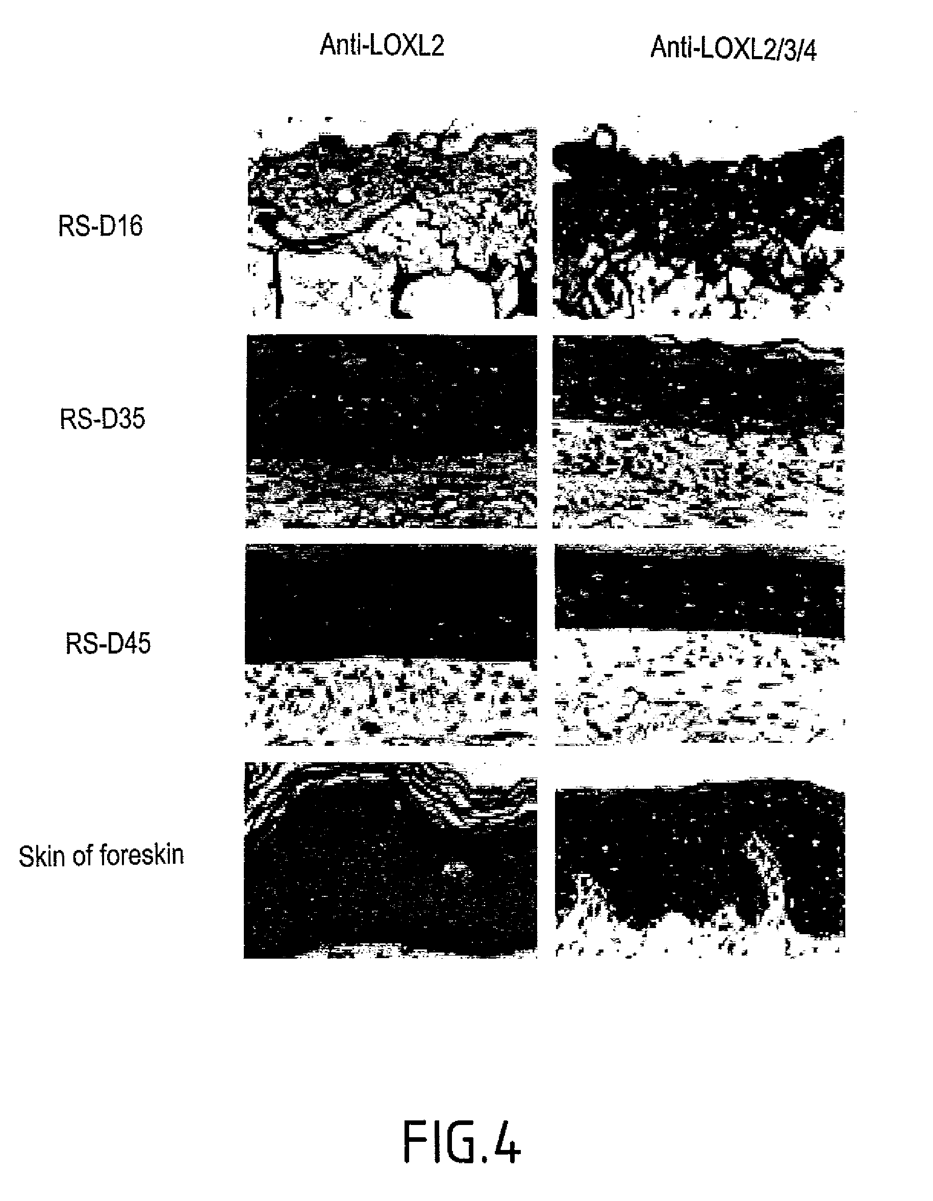 Stimulation of the synthesis and of the activity of an isoform of lysyl oxidase-like LOXL for stimulating the formation of elastic fibers.