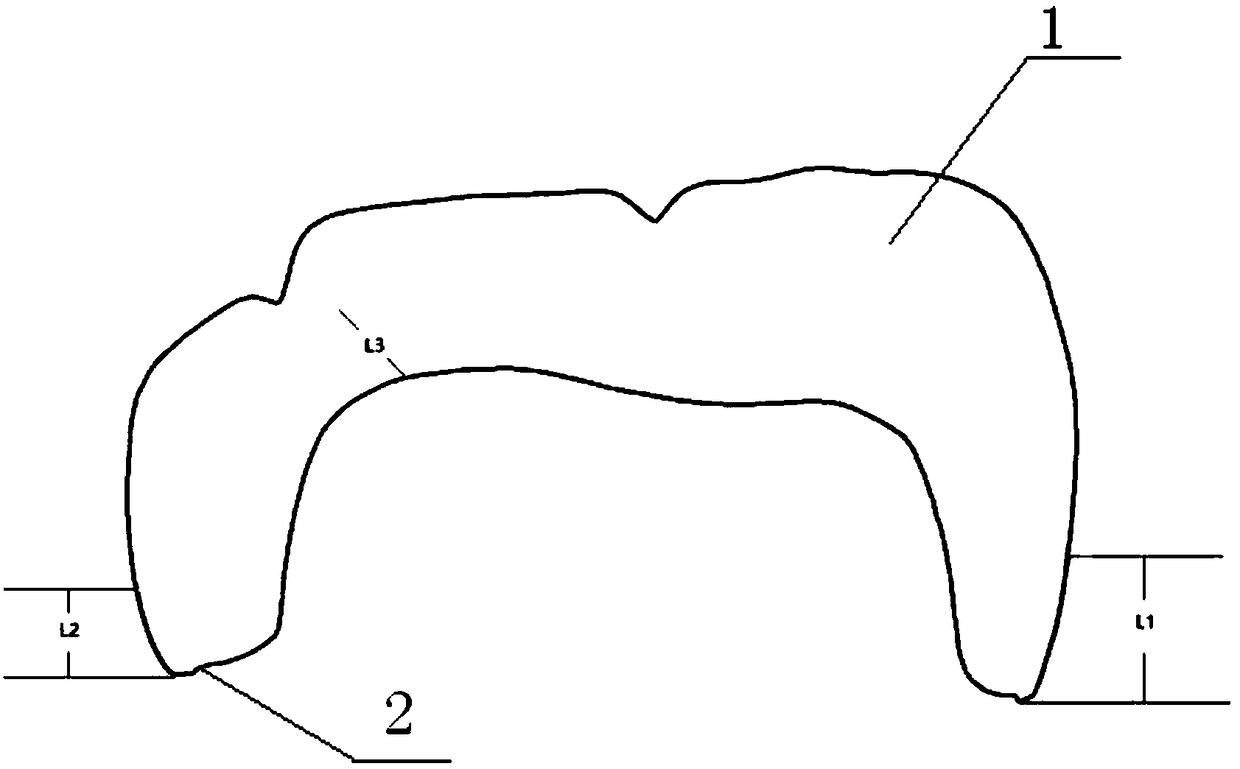 All-porcelain tooth preparation method