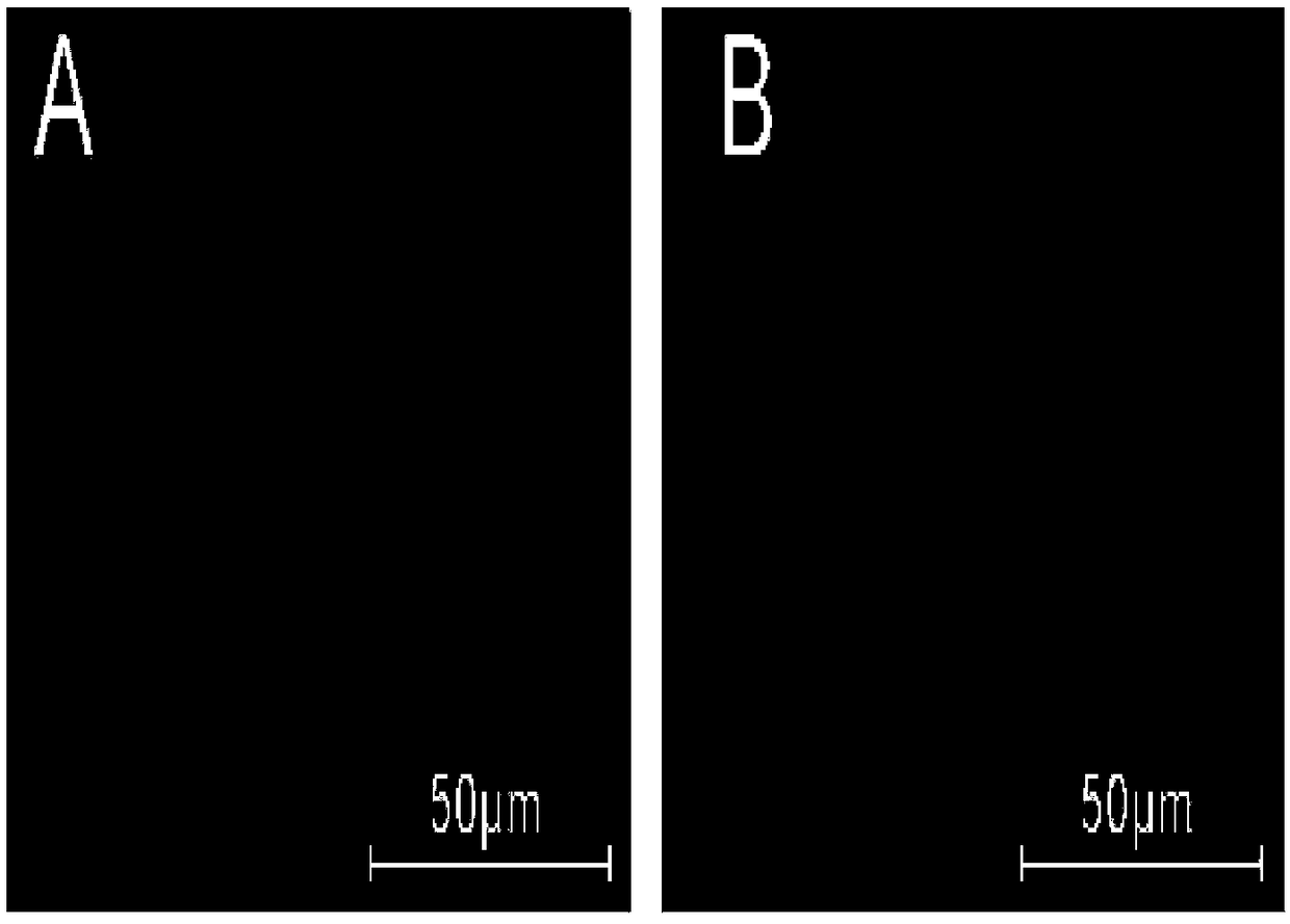 Method for establishing renal dysfunction model of mice with IgA nephropathy