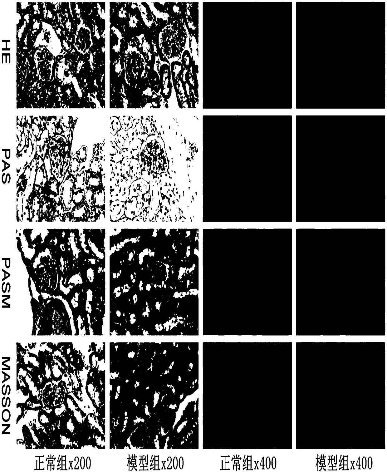 Method for establishing renal dysfunction model of mice with IgA nephropathy